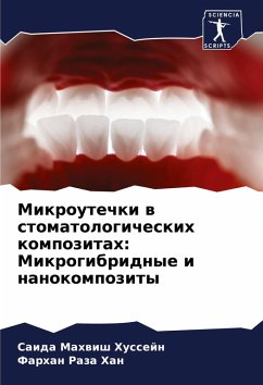 Mikroutechki w stomatologicheskih kompozitah: Mikrogibridnye i nanokompozity - Hussejn, Saida Mahwish;Han, Farhan Raza