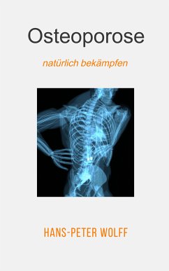 Osteoporose natürlich bekämpfen (eBook, ePUB) - Wolff, Hans-Peter