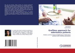 Graftless approach for edentulous patients Graftless approach for edentulous patients