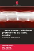 Tratamento ortodôntico e protético do diastema maxilar Tratamento ortodôntico e protético do diastema maxilar
