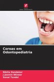 Coroas em Odontopediatria