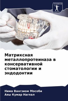 Matrixnaq metalloproteinaza w konserwatiwnoj stomatologii i ändodontii - Mosobi, Nima Vangziom;Nagpal, Aqy Kumar