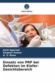 Einsatz von PRP bei Defekten im Kiefer-Gesichtsbereich