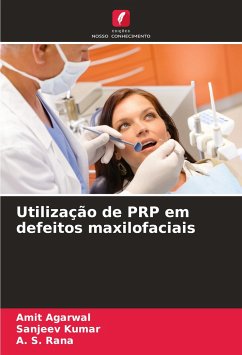 Utilização de PRP em defeitos maxilofaciais - Agarwal, Amit;Kumar, Sanjeev;Rana, A. S.