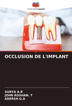 OCCLUSION DE L'IMPLANT - A.R, SURYA;ROSHAN. T, JOHN;G.A, Adersh