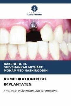 KOMPLIKATIONEN BEI IMPLANTATEN - B. M., Rakshit;Mithare, Shivshankar;Nashiroddin, Mohammed