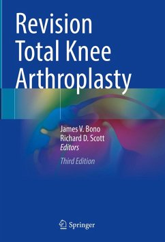 Revision Total Knee Arthroplasty (eBook, PDF) Cover Revision Total Knee Arthroplasty (eBook, PDF)