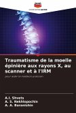 Traumatisme de la moelle épinière aux rayons X, au scanner et à l'IRM