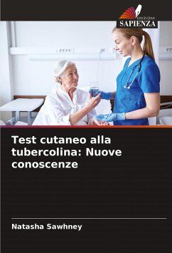 Test cutaneo alla tubercolina: Nuove conoscenze - Sawhney, Natasha