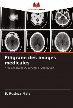 Filigrane des images médicales - Pushpa Mala, S.