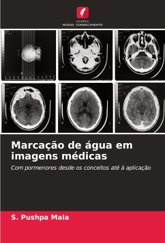 Marcação de água em imagens médicas - Pushpa Mala, S.