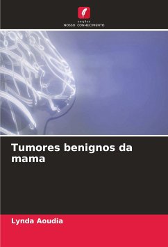 Tumores benignos da mama - Aoudia, Lynda