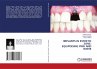 IMPLANTS IN ESTHETIC ZONE: EQUIPOISING... - Bild 1