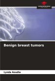 Benign breast tumors