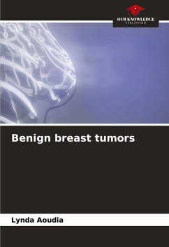 Cover Benign breast tumors