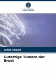 Gutartige Tumore der Brust Gutartige Tumore der Brust