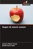 Segni di morsi umani