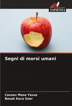 Cover Segni di morsi umani