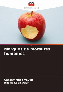 Cover Marques de morsures humaines