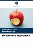 Menschliche Bisswunden