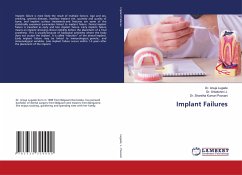 Implant Failures - Lugade, Dr. Anuja;J., Dr. Srilakshmi;Poovani, Dr. Shwetha Kumari