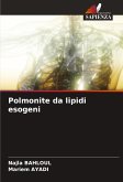 Polmonite da lipidi esogeni Polmonite da lipidi esogeni