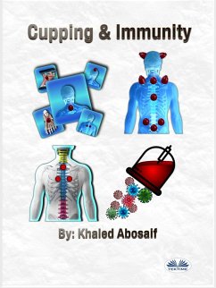 Cover Cupping & Immunity (eBook, ePUB)