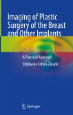 Imaging of Plastic Surgery of the Breast and Other Implants (eBook, PDF)