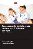 Tomographie assistée par ordinateur à faisceau conique