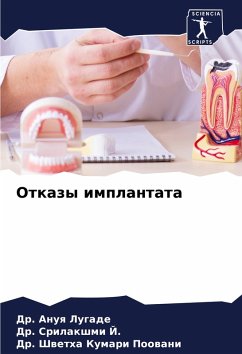Cover Otkazy implantata