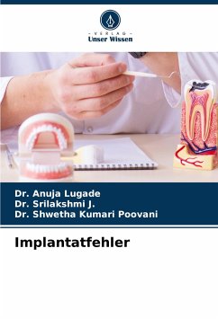 Implantatfehler - Lugade, Dr. Anuja;J., Dr. Srilakshmi;Poovani, Dr. Shwetha Kumari