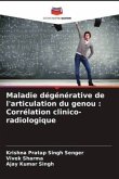 Maladie dégénérative de l'articulation du genou : Corrélation clinico-radiologique