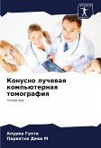 Konusno luchewaq komp'üternaq tomografiq Konusno luchewaq komp'üternaq tomografiq