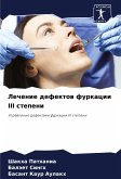 Lechenie defektow furkacii III stepeni Lechenie defektow furkacii III stepeni