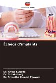 Échecs d¿implants