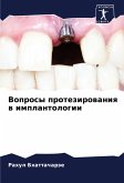 Voprosy protezirowaniq w implantologii Voprosy protezirowaniq w implantologii