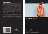 Posta e nucleo Posta e nucleo