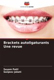 Brackets autoligaturants Une revue