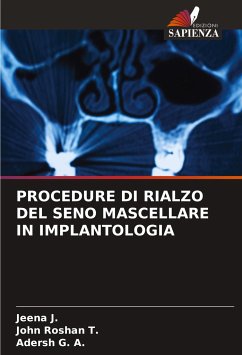 PROCEDURE DI RIALZO DEL SENO MASCELLARE IN IMPLANTOLOGIA - J., Jeena;Roshan T., John;G. A., Adersh