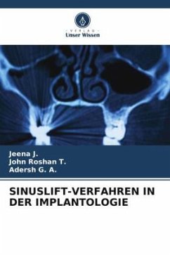 SINUSLIFT-VERFAHREN IN DER IMPLANTOLOGIE - J., Jeena;Roshan T., John;G. A., Adersh