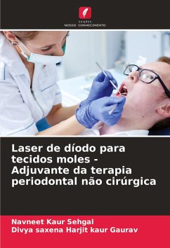 Cover Laser de díodo para tecidos moles - Adjuvante da terapia periodontal não cirúrgica