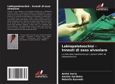 Labiopalatoschisi - Innesti di osso alveolare Labiopalatoschisi - Innesti di osso alveolare