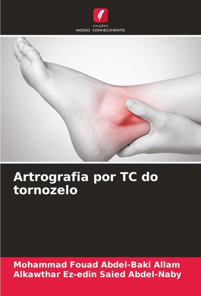 Artrografia por TC do tornozelo Artrografia por TC do tornozelo