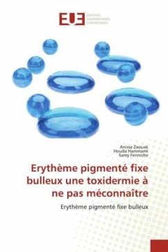 Erythème pigmenté fixe bulleux une toxidermie à ne pas méconnaître - Zaouak, Anissa;Hammami, Houda;Fenniche, Samy