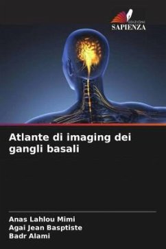 Atlante di imaging dei gangli basali - Lahlou Mimi, Anas;jean basptiste, Agai;Alami, Badr