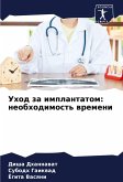 Uhod za implantatom: neobhodimost' wremeni Uhod za implantatom: neobhodimost' wremeni