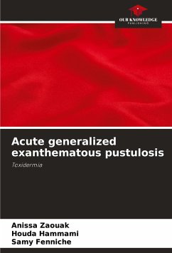 Acute generalized exanthematous pustulosis - Zaouak, Anissa;Hammami, Houda;Fenniche, Samy