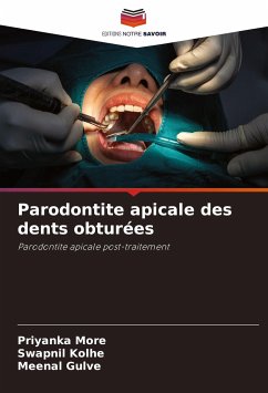 Parodontite apicale des dents obturées - MORE, PRIYANKA;Kolhe, Swapnil;Gulve, Meenal