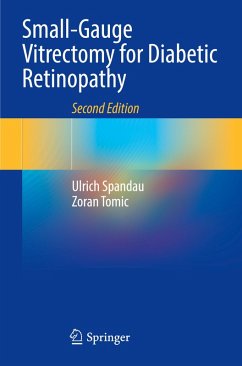 Cover Small-Gauge Vitrectomy for Diabetic Retinopathy