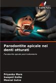 Parodontite apicale nei denti otturati